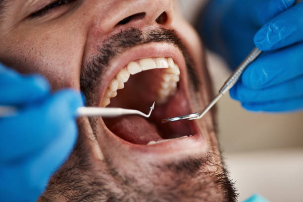 Best Emergency Dental Services for Seniors in Montecito, CA