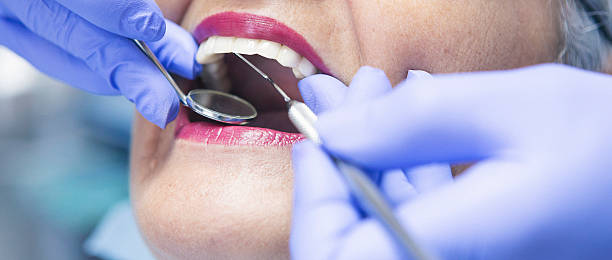 Best Weekend Emergency Dentist in Montecito, CA